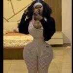 Lady suffering after removing 20 of her ribs-suffering from BBL leakage-video